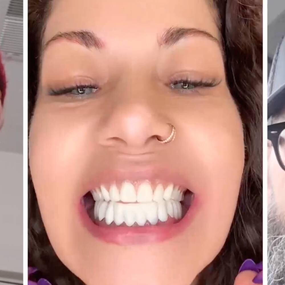 Different people smiling with WellaSmile veneers